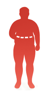 BMI Calculator - Grade II Obesity